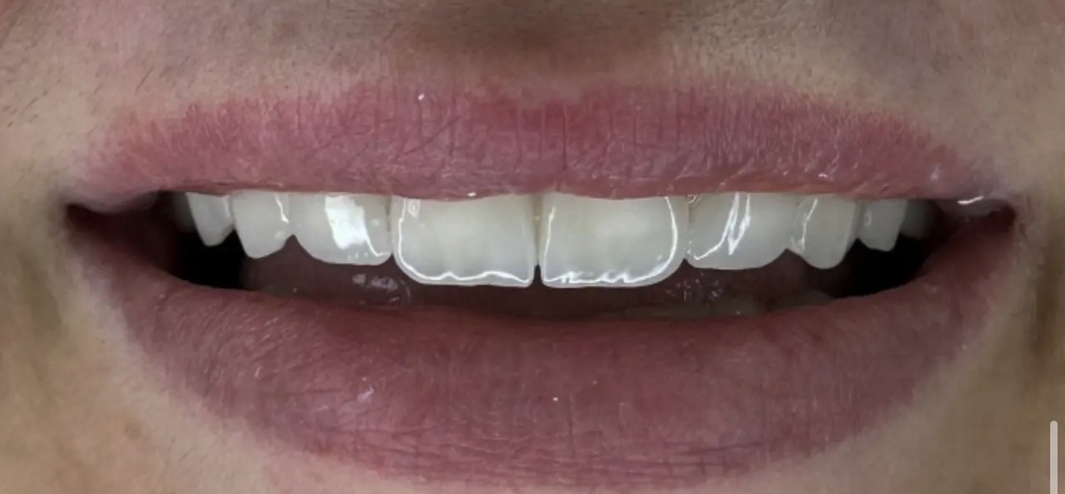 After treatment at İ-Klinik